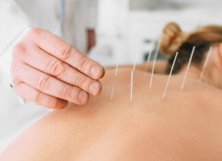 Est-ce que l’acupuncture est vraiment efficace pour maigrir ? Est-ce que l'acupuncture est vraiment efficace pour maigrir ?
