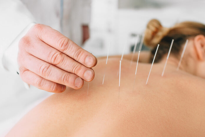 Est-ce que l'acupuncture est vraiment efficace pour maigrir ?