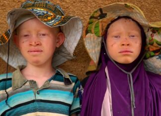 Les sorciers tanzaniens qui soignent les douleurs