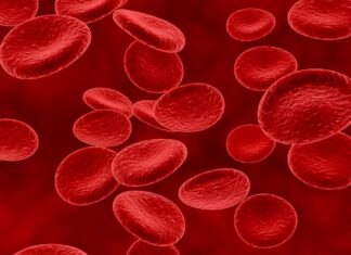 La phlébotomie thérapeutique ou la saignée phlébotomie thérapeutique