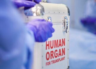 Législation sur les dons d’organes : un aperçu mondial Législation sur les dons d'organes un aperçu mondial