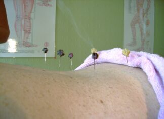 La moxibustion : la magie de la médecine traditionnelle chinoise moxibustion