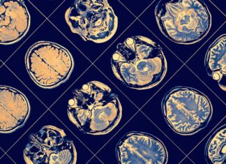 Lea, 29 ans, nous parle de la maladie de Charcot Lea, 29 ans, nous parle de la maladie de Charcot