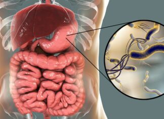 Les méthodes naturelles pour traiter l’Helicobacter Pylori