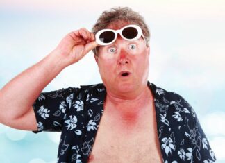 Soignez vos coups de soleil naturellement Soignez vos coups de soleil naturellement