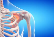 Cette plante guérie vos os Cette plante africaine guérie vos os