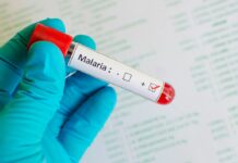 La malaria: laboratoire ou traitement naturel? La malaria laboratoire ou traitement naturel