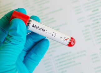 La malaria: laboratoire ou traitement naturel? La malaria laboratoire ou traitement naturel