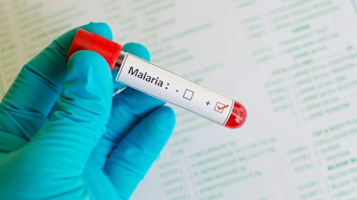 La malaria laboratoire ou traitement naturel