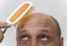 Les derniers remèdes contre la calvitie comparaison avec les remèdes naturels remèdes contre la calvitie