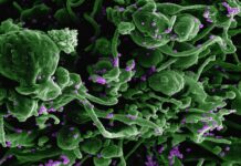 Fermentation médicinale, quand les aliments deviennent des alliés de la santé La fermentation médicinale